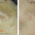 Monkeypox: ‘No need for South Africans to panic’