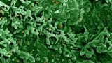 COVID sewage surveillance labs join the hunt for monkeypox – WAMU 88.5