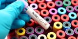 Poliovirus Discovered in NYC Wastewater – Consumer Health News