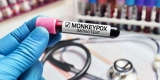 Second Person in U.S. Dies After Monkeypox Diagnosis – Consumer Health News
