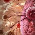 Doctor says case numbers underestimate latest surge