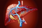Past COVID-19 Infection Could Play Role In Child Hepatitis