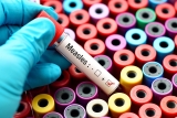 CDC Mandates Measles Quarantine for Afghanistan Evacuees