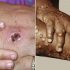 Tuscarawas County reported 121 additional COVID-19 cases this week