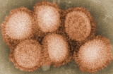 Health News Roundup: Hungary reports H5N1 bird flu at turkey farm; India’s Kerala state culls hundreds of birds after avian flu outbreak and more