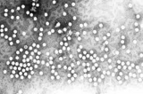 Health News Roundup: Third possible case of monkeypox found in the U.S; North Korea’s fever cases under 200,000 for 2nd day amid silence on aid offer and more