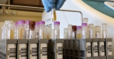 C.D.C. advisers are meeting to discuss Novavax’s Covid vaccine.