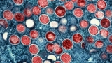 Monkeypox is not a side effect of the COVID-19 vaccine