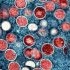 US allows fractional dosing of monkeypox vaccine to extend supply