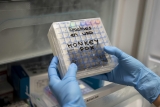 CDC raises monkeypox travel warning to level 2 as global cases pass 1,000