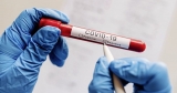 World Health Organisation reports drop in new coronavirus infections