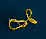Ebola case in Abidjan, Ivory Coast: Africa CDC, Statement from hospital
