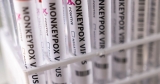 With monkeypox, the world must heed the lessons of HIV/AIDS | Health