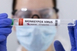 Monkeypox latest: Scotland’s cases rise as NI and Wales log first infections