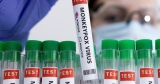 India confirms Asia’s first monkeypox death | Health News