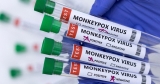 EU approves smallpox vaccine for use against monkeypox | Health News