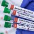 CDC adds destinations to ‘high’ risk list for COVID-19