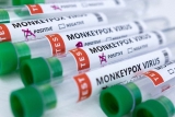 Surge in global monkeypox cases prompts fresh concern by World Health Organisation