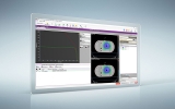 commissioning and first clinical results – Physics World