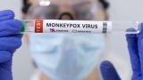 Europe to consider ‘dose-sparing’ to increase monkeypox vaccine, WHO seeks trials