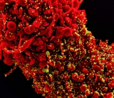 COVID-19 was third leading cause of death in the United States in both 2020 and 2021