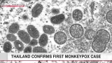 Thailand confirms first monkeypox case
