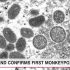 Mask advisory issued in Franklin County as COVID cases increase