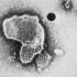 What is the link between influenza vaccination and the severity of COVID-19 infection?