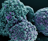 NIH seeks the next generation of COVID-19 diagnostics