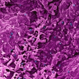 U.S. clinical trial evaluating antiviral for monkeypox begins