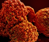 NIH-funded team develops method to identify future SARS-CoV-2 mutations that could affect rapid antigen test performance
