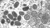 CDC: Single vaccine dose reduces risk of monkeypox