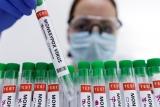 Monkeypox can be contained if we act now, says World Health Organisation : The Tribune India