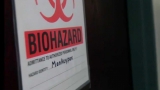 New Hampshire monkeypox case confirmed by CDC