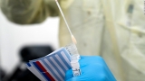 Coronavirus: As BA.2 subvariant of Omicron rises, lab studies point to signs of severity