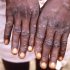Video CDC issues new health alert on monkeypox – ABC News