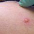 How Many Days Do COVID Antibodies Stick Around? | Health