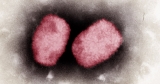 Monkeypox likely spread by sex at two raves in Europe, expert says