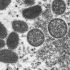 CDC issues new guidance on monkeypox symptoms as U.S. cases rise
