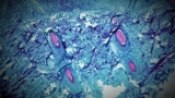 Video CDC officials investigate 5 presumptive monkeypox cases in US – ABC News