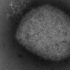 CDC Tests Inconclusive, Case Treated as Presumptive Positive – NBC New York