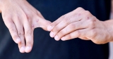 How monkeypox spreads: Experts clear up misinformation