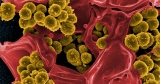 Superbug infections spiked in pandemic’s first wave
