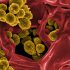 Quest launches monkeypox PCR test as U.S. attempts to catch up with rising cases
