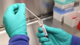 Monkeypox is on the rise in the LGBTQ community. Here’s what to know