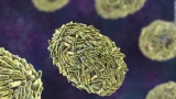 What is monkeypox, and how can you stay safe while it spreads?