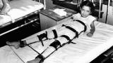 Polio 101: Signs, symptoms and dangers