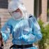 HIV patients at risk of severe illness if infected with monkeypox