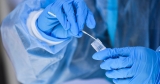 Symptoms can recur even in people who have not taken Paxlovid