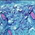 Millions of US children remain unvaccinated as BA.5 spreads and new school year looms